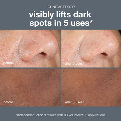 Powerbright dark spot peel